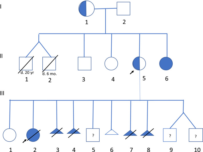 【佳学基因检测】Cornelia de Lange综合征阻断遗传可以吗？