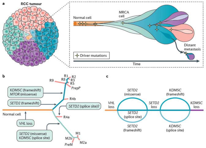 【佳学基因检测】肾脏癌靶向药物基因检测（Kidney Cancer)