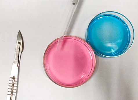 【佳学基因解码-基因检测】杜氏肌营养不良会不会遗传？如何避免后代患病？