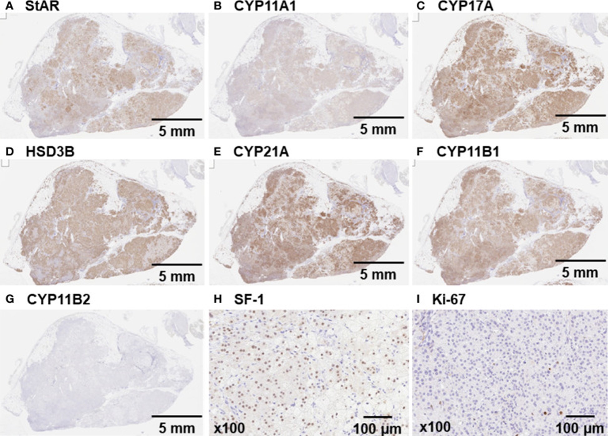 【佳学基因检测】非依赖性库欣综合征及McCune-Albright 综合征伴有中枢性闭经和甲状腺功能减退症的基因检测 【佳学基因检测】非依赖性库欣综合征及McCune-Albright 综合征伴有中枢性闭经和甲状腺功能减退症的基因检测