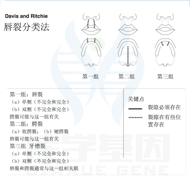 【佳学基因检测】唇裂不同分类命名系统的比较与统一