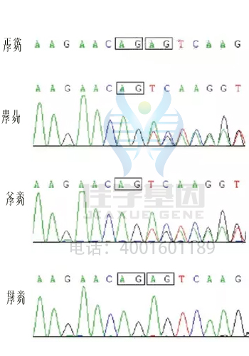 【基因检测基因解码案例】巴特综合症——佳学基因 【基因检测基因解码案例】巴特综合症——佳学基因